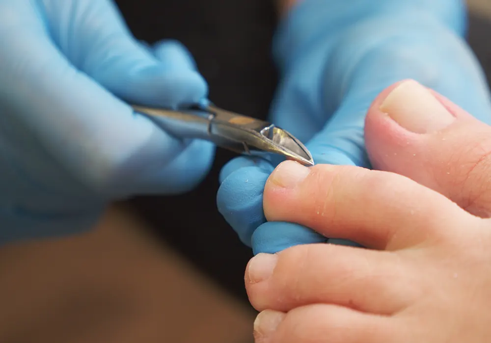 Varpaankynsien leikkaus